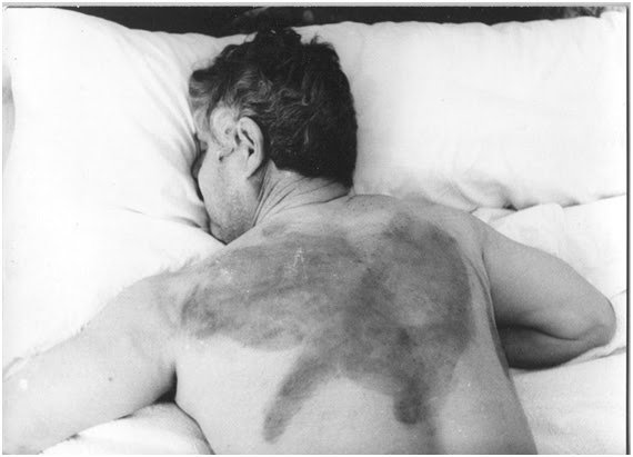 Lesions Antonio Plata Palma
