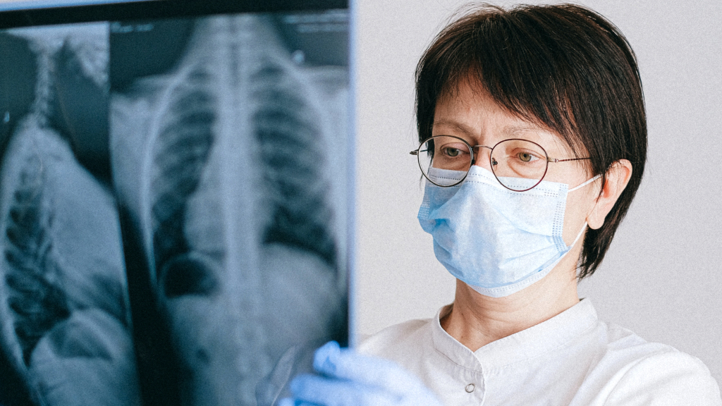 Doctora Radiografia Pulmons Cancer
